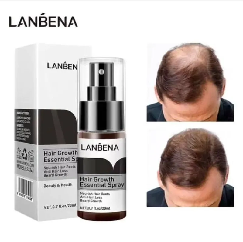 اسپری تقویت مو لانبنا LANBENA