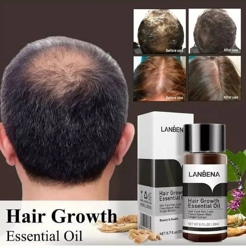 قطره‌ تقویت مو لانبنا   LANBENA