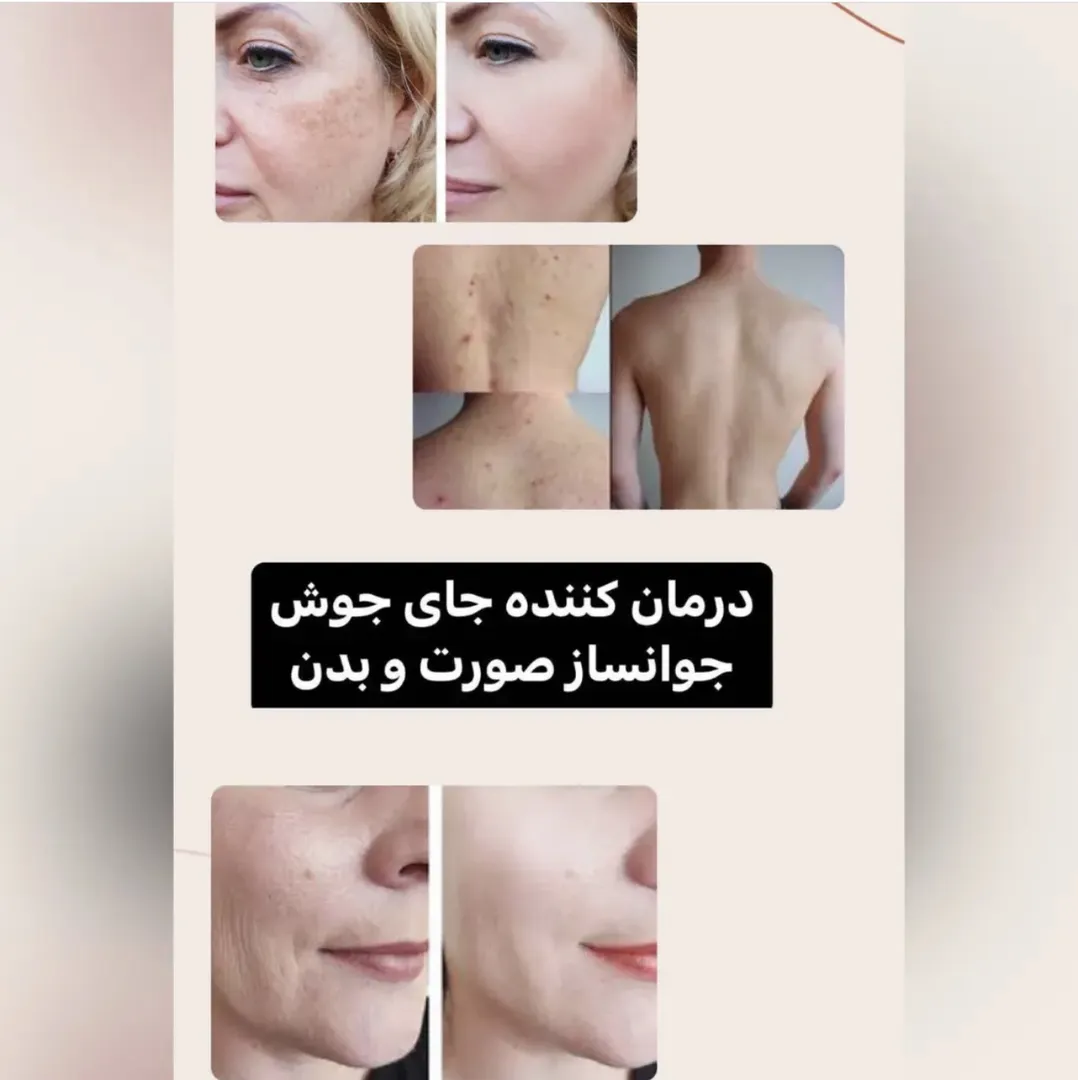 سرم روشن کننده و سفید کننده AHA